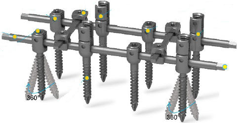 Система для транспедикулярної фіксації хребта (6 гвинтів)